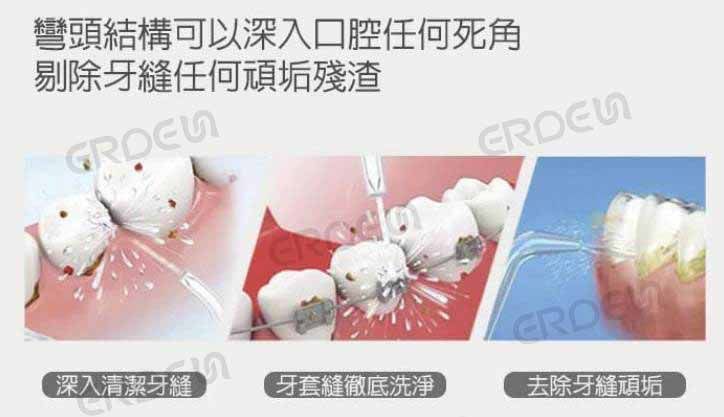 漱口水沖牙器使用方式