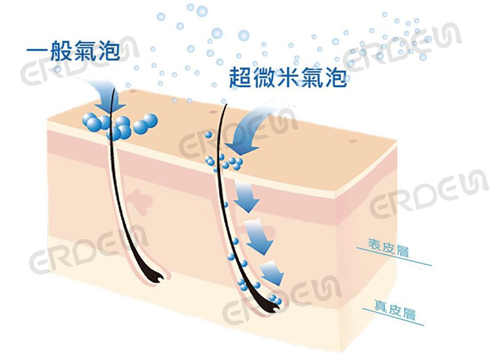 마이크로 버블이 피부 모공을 깊이 청소합니다.